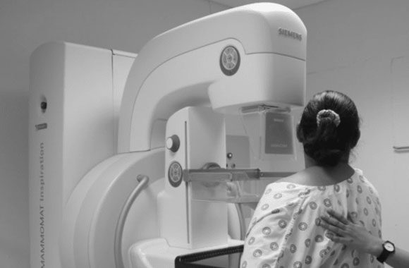 mammography